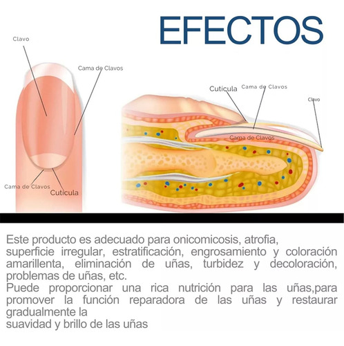 32 Parches Reparacion Uñas Nail Hongos Extracto De Hierbas
