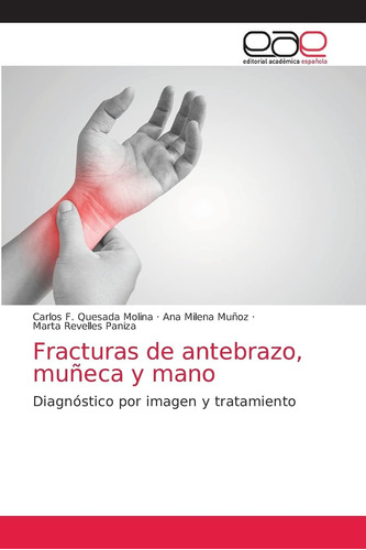 Libro: Fracturas De Antebrazo, Muñeca Y Mano: Diagnóstico Po