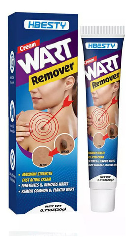Crema Removedora De Verrugas Skin Para Eliminar Lun
