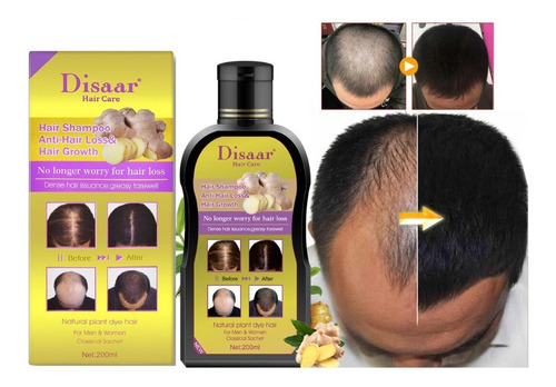 Imagen 2 de 8 de Shampoo Anti Caída De Cabello Reparador Alopecia Y Calvicie