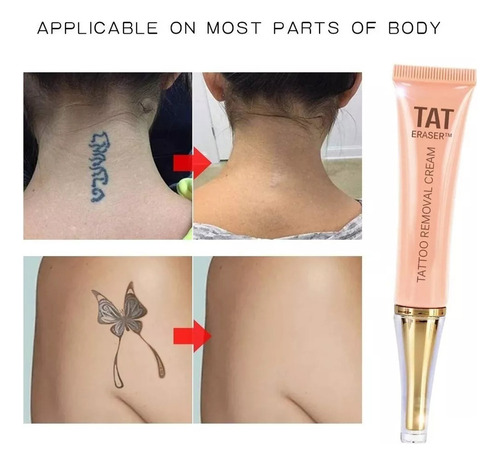 ~ Remoção Permanente Da Tatuagem Do Creme Da Remoção Da