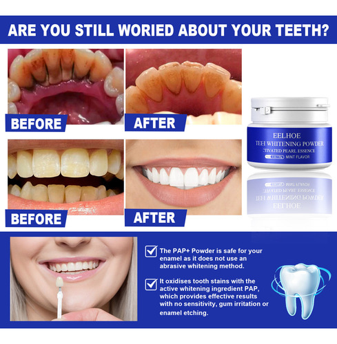 Polvo Dental Blanco Iluminador O Active Para Limpieza Bucal