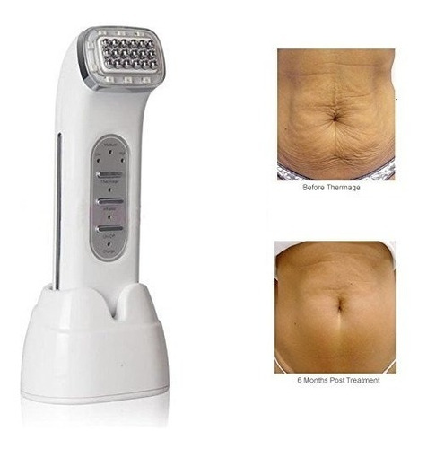 Radiofrecuencia Skin Face Rf Máquina Facial De Belleza