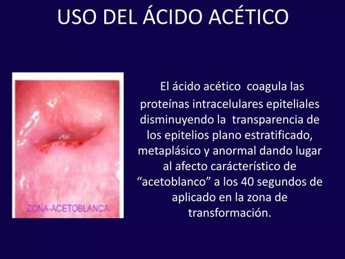 Acético Uso Ginecológico 5 % 1.000 Ml - Caflab -