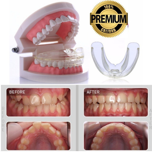 Ortodoncia Invisible Adultos Brackets Agnovedades