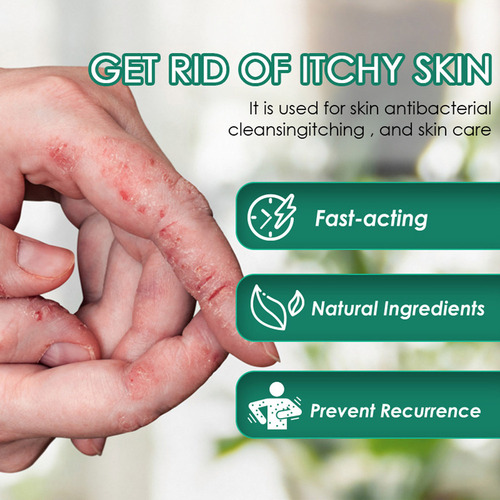 Pomada Para Picazón, Psoriasis Y Musgo, Crema Para Dermatiti