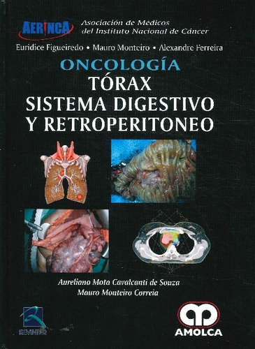 Oncología Tórax Sistema Digestivo Y Retroperitoneo, De Mauro Monteiro Correia Euridice M Almeida Figueiredo Alexand. Editorial Amolca, Tapa Blanda En Español, 9999