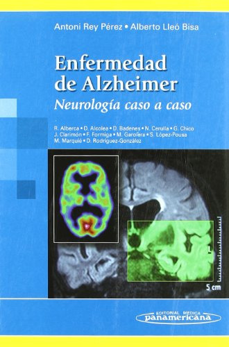 Libro Enfermedad De Alzheimer De Antoni Rey Pérez, Alberto L