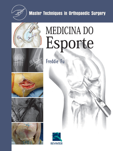 Medicina do esporte: Master Techniques In Orthopedic Surgery, de Fu, Freddie. Editora Thieme Revinter Publicações Ltda, capa dura em português, 2015