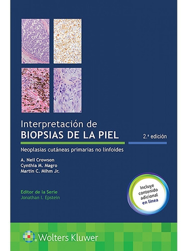 Interpretación De Biopsias De La Piel Crowson Envíos T/país