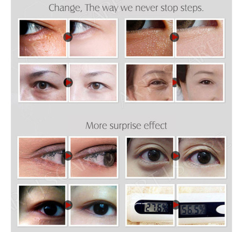 Aging Hydraterende Olie-control Whitening Xpvn