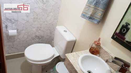 Imagem 22 de 30 de Maravilhoso Sobrado 84m² Em Condomínio Fechado Com 2 Suítes Rico Em Planejados Com 1 Vaga. R$ 450.000 - Imirim / Sp - (11)97200-3334 - Cláudio. - So1606