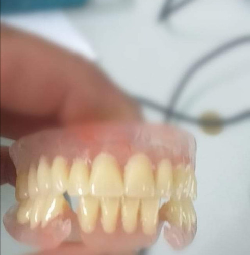 Imagen 2 de 5 de Prótesis Dentales, Reparaciones, Laboratorio Odontológico