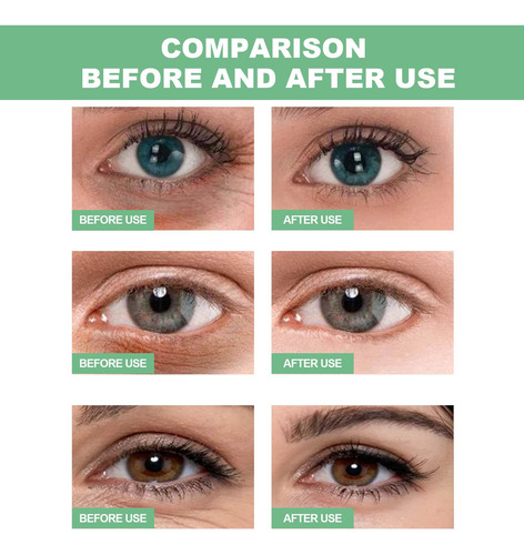 30 Pares De Mascarillas De Aloe Para Debajo De Los Ojos, Sop