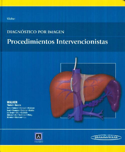 Libro Diagnóstico Por Imagen Procedimientos Intervencionista