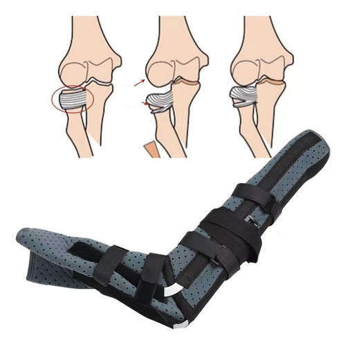 Sling Unissex Para Cotovelo, Úmero, Tala
