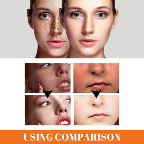 Crema Removedora De Pecas Facial Blanqueadora Y Aclaradora Y