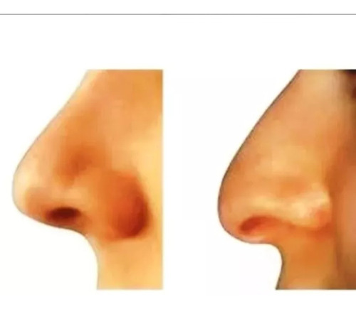 Protesis Corrector Nasal Instantaneo Original 8 Pares