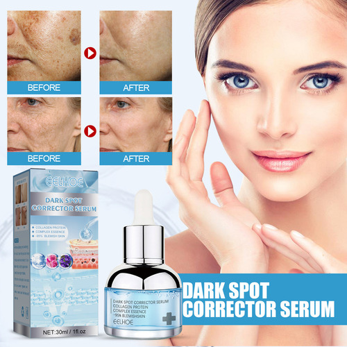 Sérum Corretor De Manchas Escuras, Seguro Para Ovelhas, Não