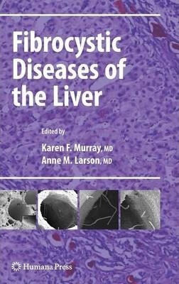 Fibrocystic Diseases Of The Liver - Karen F. Murray (hard...