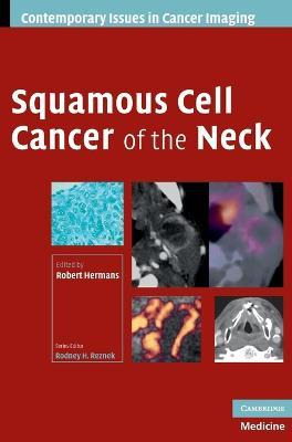 Libro Contemporary Issues In Cancer Imaging: Squamous Cel...