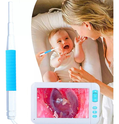 Otoscopio Digital Con 6 Luces Led, Tarjeta Tf De 32 G, 3,9 M