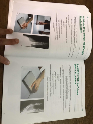 Imagem 3 de 7 de Posicionamento Em Radiologia - Editora Corpus