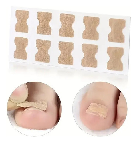 Adesivo Correção Unhas Encravadas Desencravador - 50 Peças