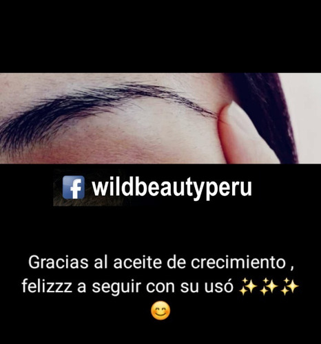 Aceite Pestañas, Espesas Largas, Fuertes Y Brillantes