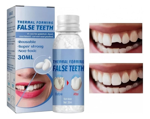 -- Perlas Reparación Dientes Postizos Dientes Gránulos 30ml