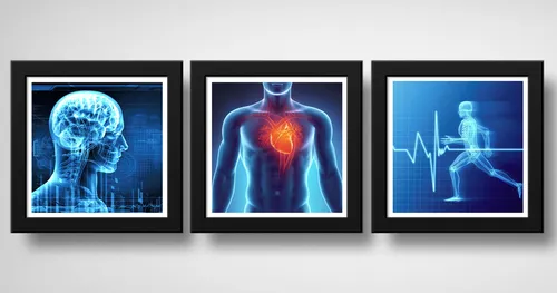comprar Set 3 Cuadros Medico Rayo X Anatomia Cuerpo Humano - 33x33cm Marco Negro