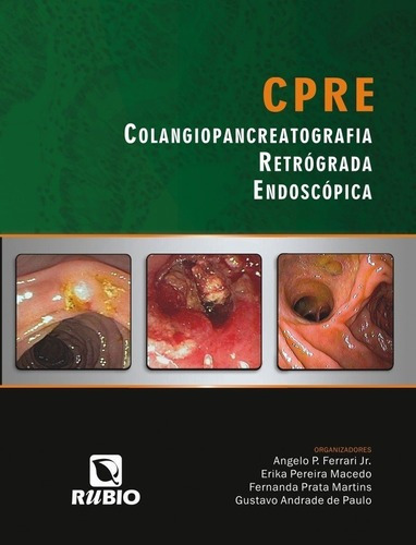 Imagem 1 de 3 de Livro Cpre Colangiopancreatografia Retrógrada Endoscópica