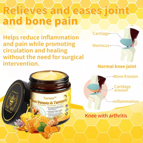 A Crema De Tratamiento De Artritis Con Cúrcuma Y De