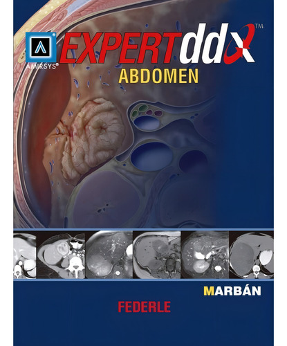 Expert Ddx Abdomen