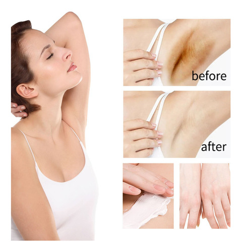Crema Blanqueadora Para La Piel, Crema Blanqueadora Para La