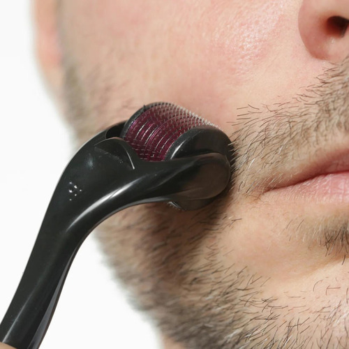 Dermaroller 0.75 mm 540 Agulhas Derma Roller System Anti Idade Smart Rolo Dermaroller Crescimento capilar