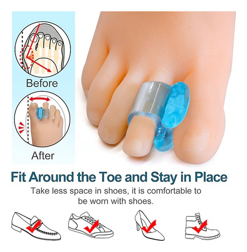 Par Separador De Dedo De Silicona Corrector De Pulgar Hallux