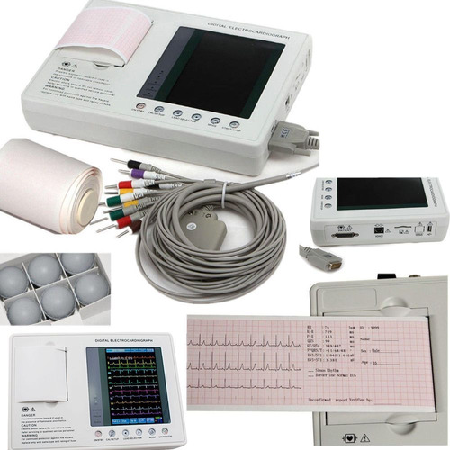 Electrocardiografo Digital  12 Canales  Pantalla Lcd Gráfica