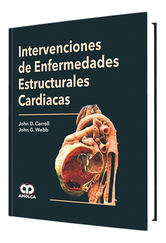 Intervenciones  Enfermedades Estructurales Cardiacas. Amolca