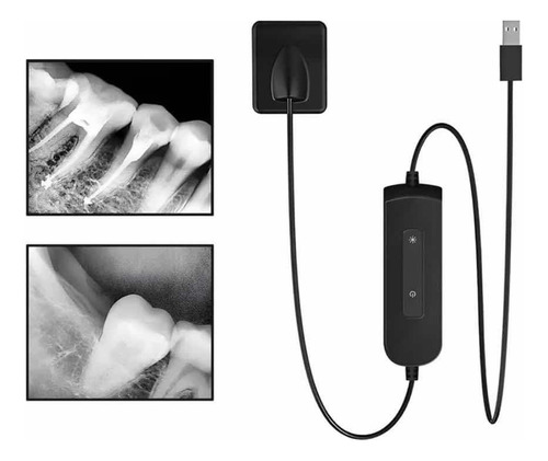 Sensor De Odontología Dental Radiovisografo Digital