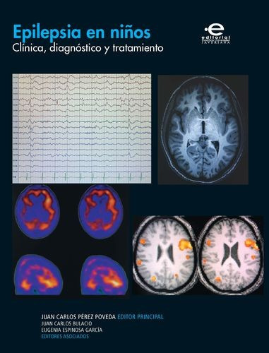 Libro Epilepsia En Niños. Clínica, Diagnóstico Y Tratamient