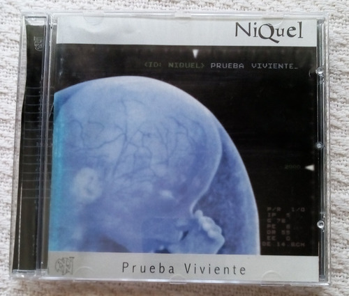 Níquel - Prueba Viviente ( C D 2000)