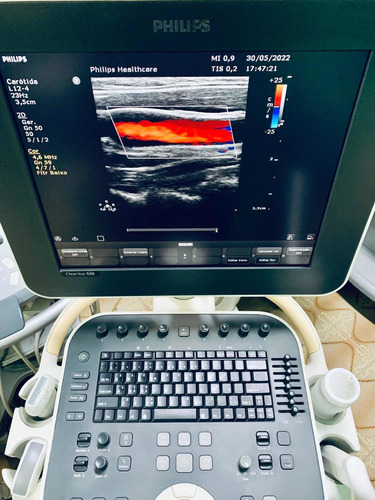 Ultrassom Philips Clearvue 550 Gineco Obstetrícia Vascular