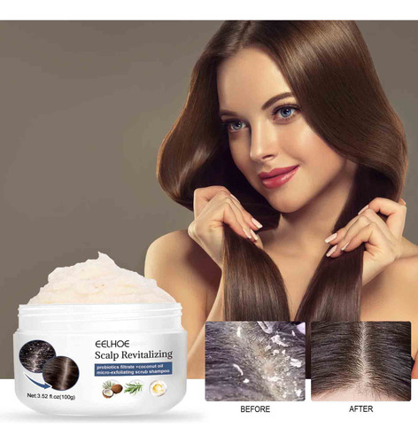Shampoo De Enxofre Para Remover Piolhos, Aliviar A Coceira,