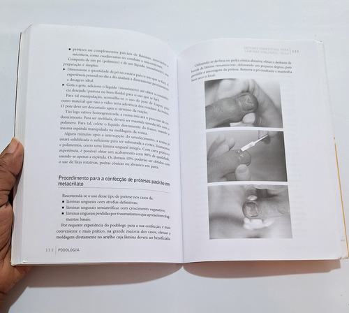 Livro Podologia Técnicas De Trabalho E Instrumentação No Atendimento De Patologias Dos Pés Paulo Piedade (Usado)