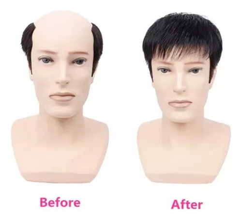 Prótesis Capilares Orgánicas Naturales Para Hombres Cabello