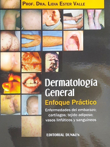 Valle Dermatología General Enfoque Práctico Envíos A T/país