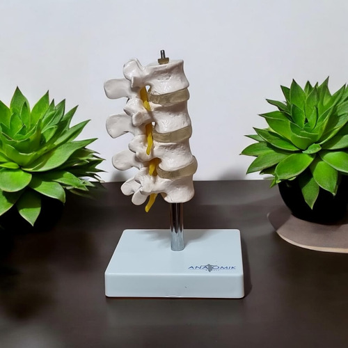 Modelo Anatomico De Set Lumbar En 4 Pzas Anatomik Didactico