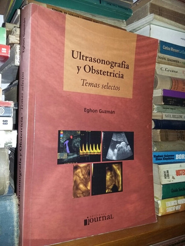 Ultrasonografia Y Obstetricia Eghon Guzman Nuevo
