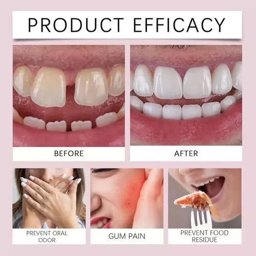 Mk Fh Adhesivo Termoplástico Para Prótesis Dental 3 Piezas